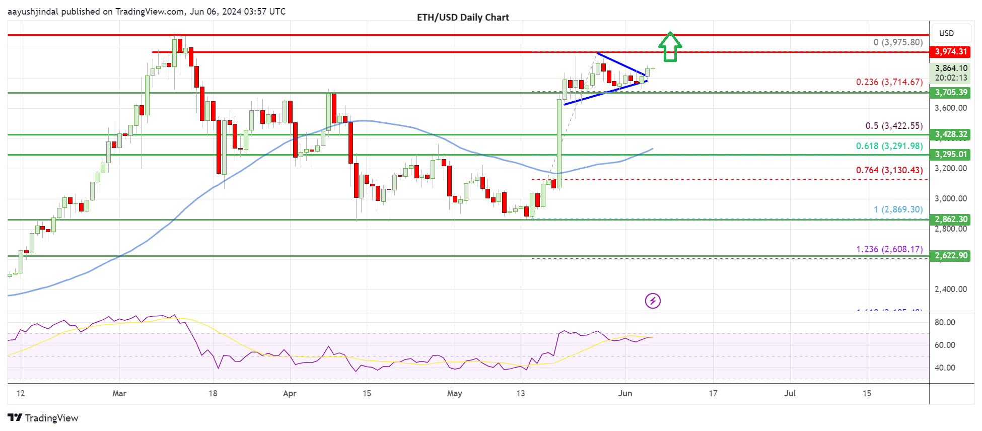 Ethereum price daily chart | Source: ETH/USD on TradingView.com